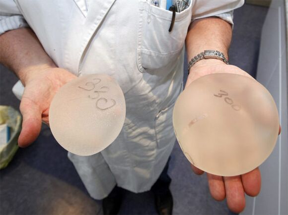 implantes mamarios para agrandar el busto